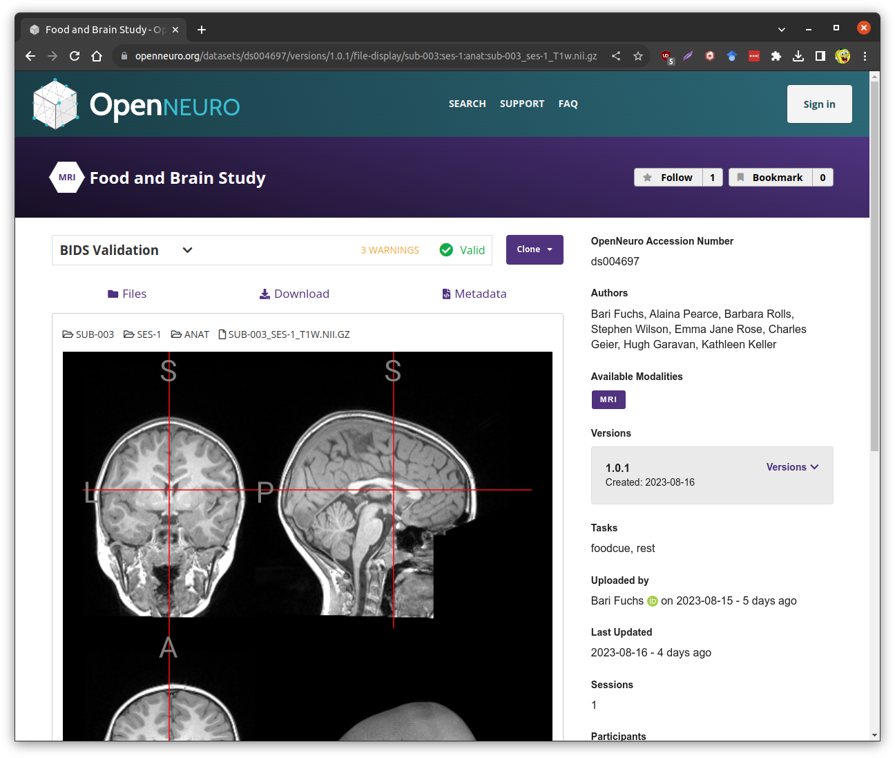 OpenNeuro.org